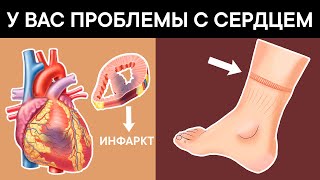 9 тревожных признаков того, что у Вас проблемы с СЕРДЦЕМ + ТОП 3 продукта для сердца