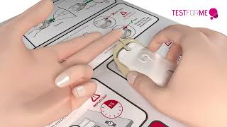 Der HIV-Schnelltest ByMe