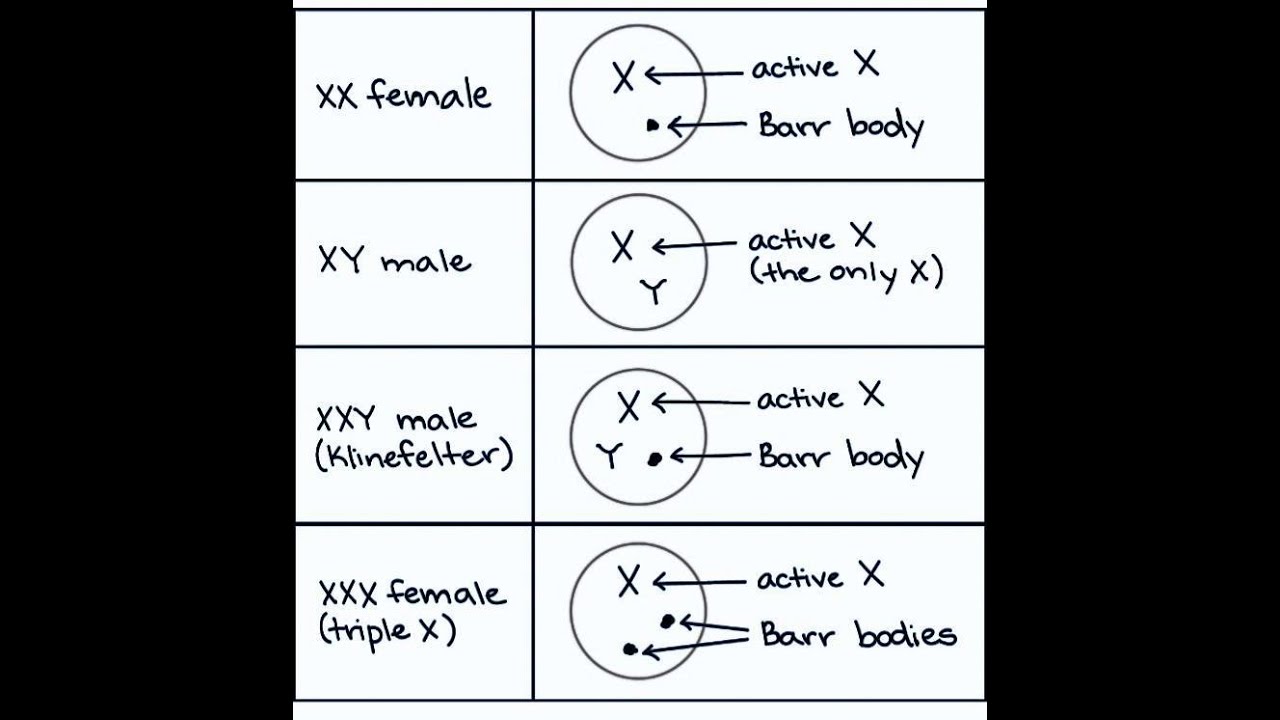 Congenital Anomalies of the Barr Body; Turner's syndrome and