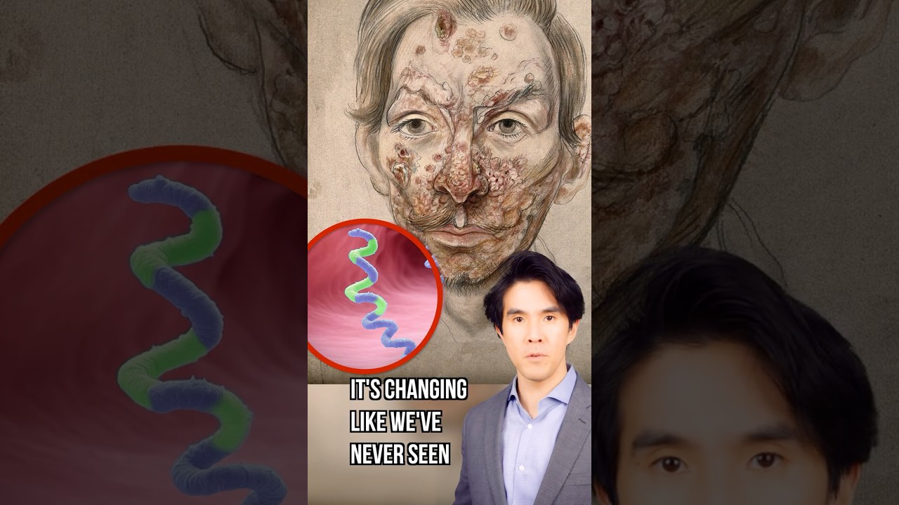 Syphilis Situation In Seattle Is Insane 😳