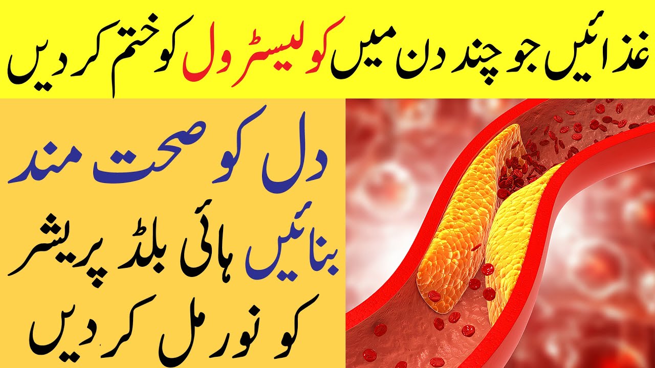 Bad Cholesterol ko Khatam karne Wale Food Food that Reduce bad