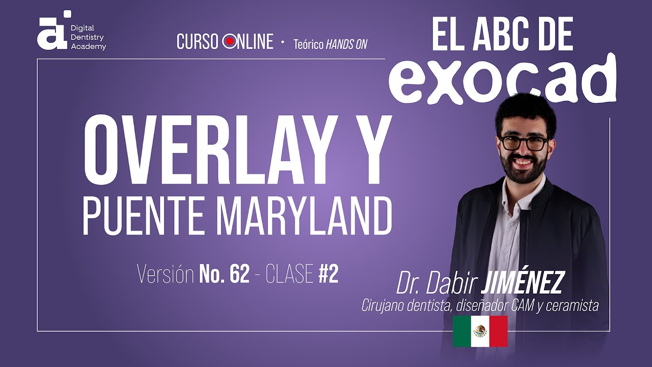 Cómo realizar Overlay y Puente Maryland en #EXOCAD / El ABC de Exocad - Versión #62 Clase #2