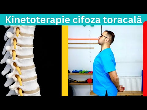 Kinetoterapie pentru cifoza
