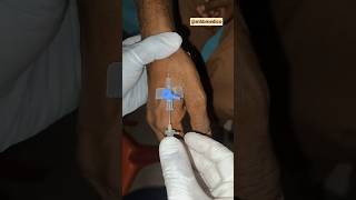 Perfect IV Cannula Insertion Technique 💉 | Step-by-Step Guide #shorts