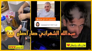 عبد الله الشهراني صار اصلع ?? | سنابات عبدالله الشهراني