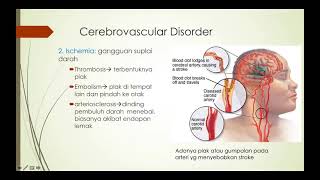 Neuroplastisitas dan kerusakan otak