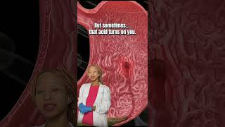 Clinically, a lot of people don’t recognize early ulcer symptoms