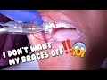 I got my Braces Off -  Tooth Time Family Dentistry New Braunfels