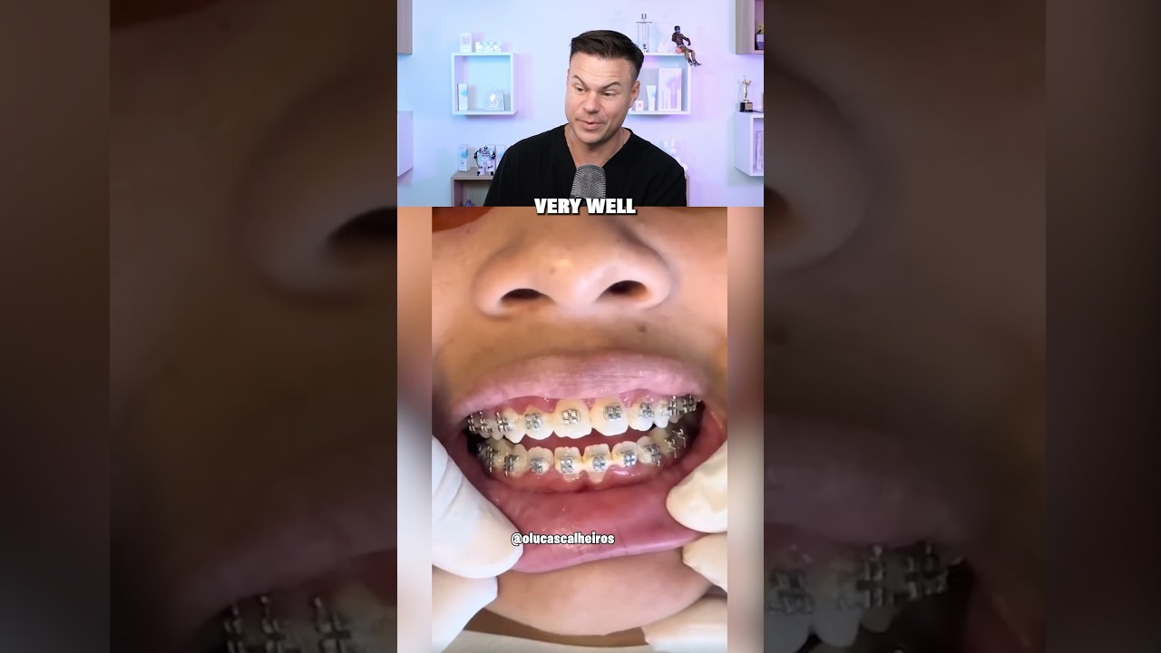 Why You NEED To Brush Your Teeth Daily! 😮🦷