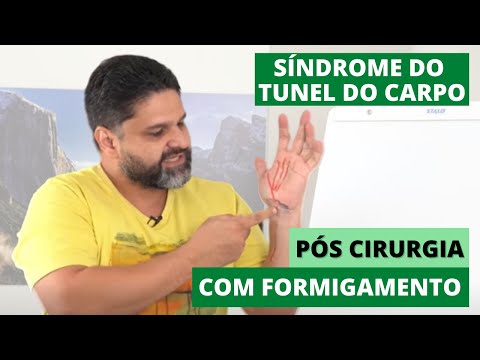 Vídeo: Como cuidar da umidade da pele: 15 etapas (com fotos)