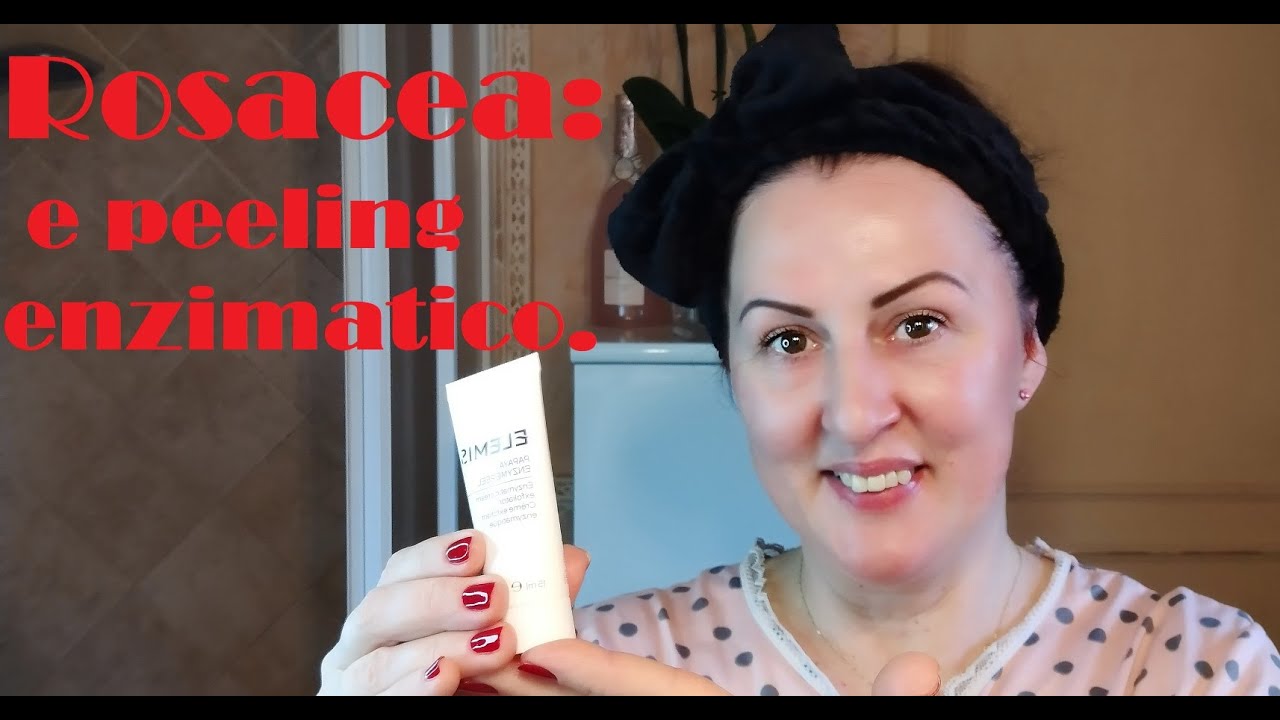 Come combattere la Rosacea,Couperose part.4 con peeling enzimatico a