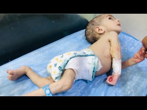 Baby Abubakar Feeling Better Niculife Newbornbaby Cutebaby 