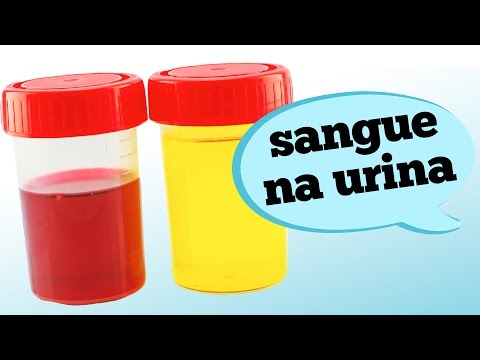 Vídeo: Devo ficar alarmado com sangue na minha urina?