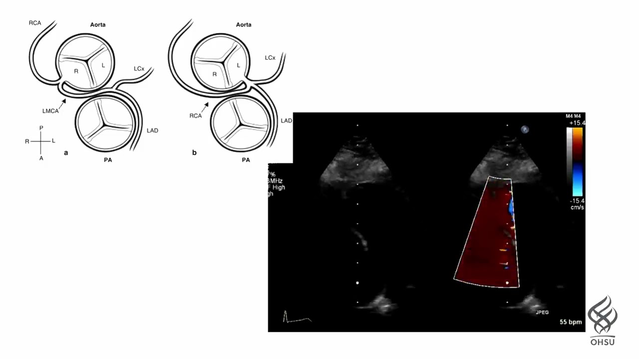 Keeping Athletes Safe: Cardiac Risk Assessment and Emergency Action Plans For Youth Sports