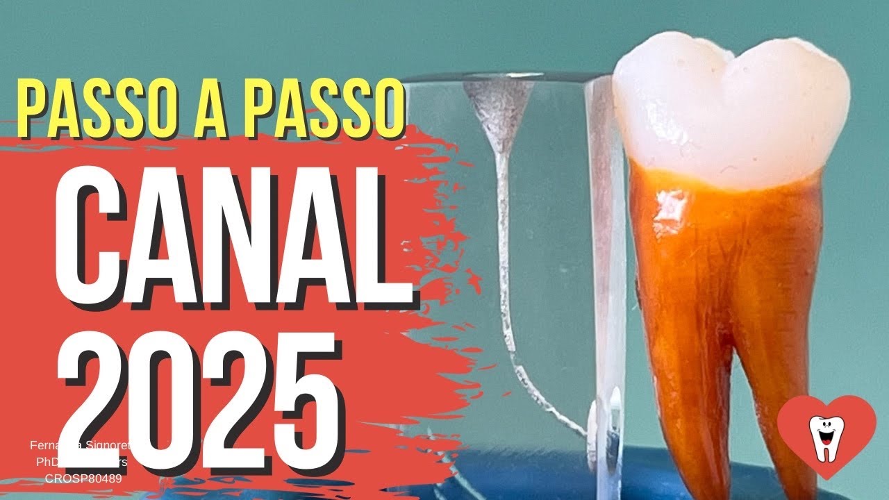 ENDODONTIA 2025: PROTOCOLO SESSÃO ÚNICA - SEGURO E BARATO - ENDOLOVERS