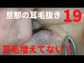 【旦那の耳毛19】耳毛増えてない？の問いに旦那が答えた。ear hair plucking