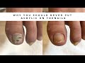 Why You Should Never Put Acrylic On Toenails