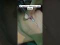 #iv injection lagane ka sahi tarika #youtubeshorts