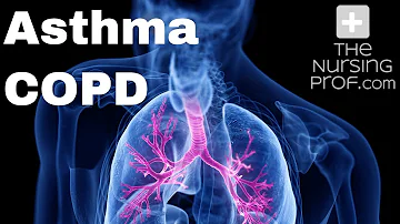 Is SERETIDE for asthma or COPD?