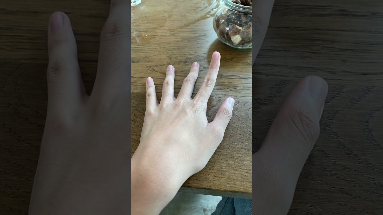 Can you lift your ring finger? 