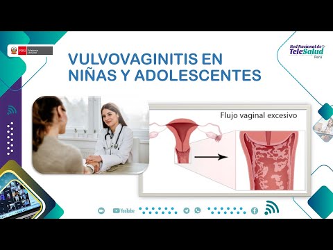 Video: Vulvitis En Niñas: Causas Y Tratamiento