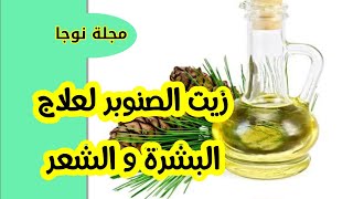 زيت الصنوبرلا تستغني عنه أبدا بعد التعرف علي فوائده الرائعة و الجمالية للإنسان |فوائد زيت الصنوبر