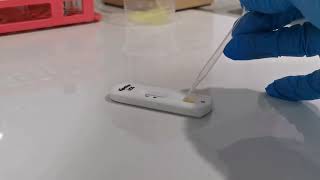 pregnancy test using blood serum as sample step by step procedure