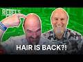 Bald Billion-Dollar Breakthrough? Veradermics Sends Hair (and Stocks) Surging | Rebel’s Edge