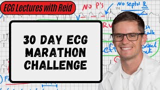 Normal Sinus Rhythm | Day 1 ECG Challenge