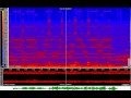 Miniature de la vidéo de la chanson L'expérience Acoustique : Iii. La Preuve Par Le Sens : L'ecriture Acoustique