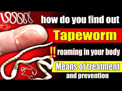 Signs that you have tapeworms living inyour body! how do you find out? Means of treatment&amp;prevention