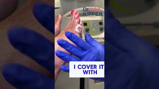 5th Toe Corn Pad ... and debridement  | Part 2 #CornPad #Debridement #drnailnipper