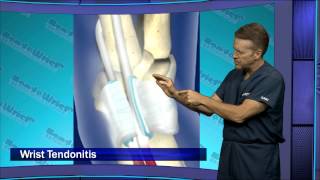 HAWTV Ep. 2 - Tennis Wrist Injuries and Prevention