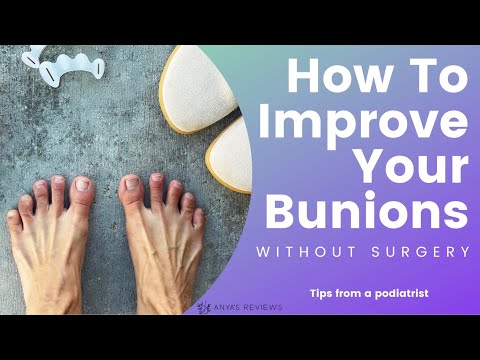 6 Exercises to Treat Bunion  Australian Healthcare Supplies