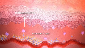 How does Rocatinlimab block OX40? - 3D Medical Animation