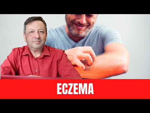 Video: 3 moduri de a ameliora mâncărimea eczemei noaptea