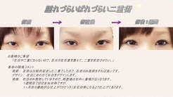美乳豊胸 脂肪吸引 二重埋没法 湘南美容外科 銀座院 美容整形 長谷川院長 Youtube