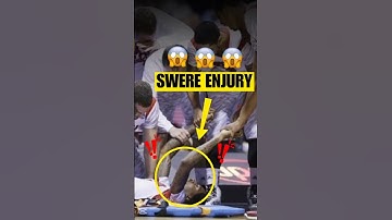 😨PIJNLIJKE BEENBREUK van Kevin Ware (Hoe heeft hij het overleefd?) #shorts #kelvinware