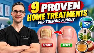 Don't Let Toenail Fungus Spread: 9 Proven Home Treatments
