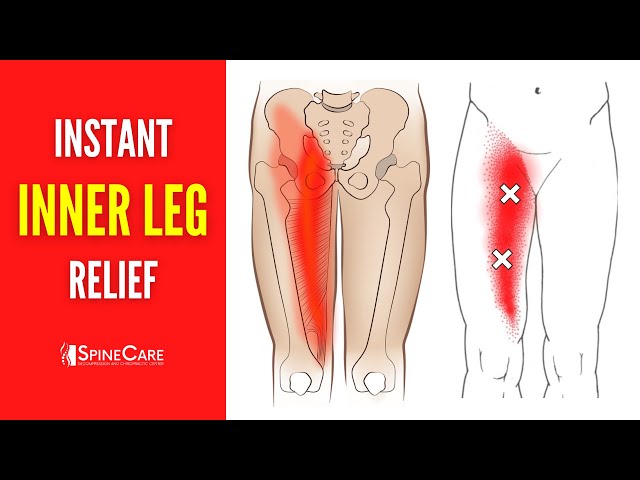 How to Fix Inner Leg Pain FOR GOOD 