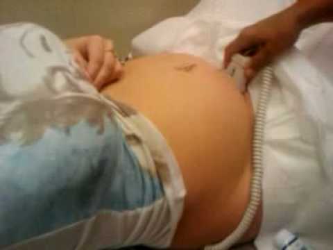 Pregnant Baby Heartbeat 7