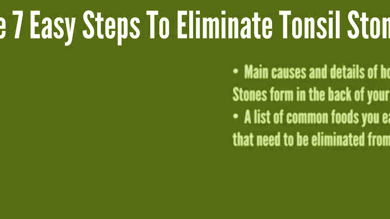 How To Get Rid Of Tonsil Stones Fast Natural | Treatment For Tonsil