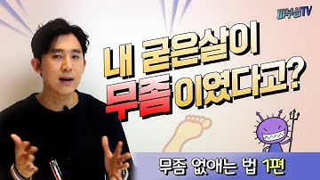 무좀 치료? 제거? 제대로~ 없애는 법 1편!