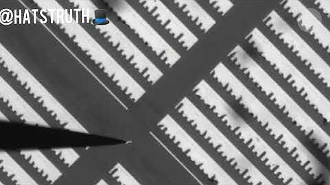 Nano-Robots in your bloodstream is the future of Medical Science