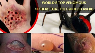 WORLD’s TOP VENOMOUS SPIDERS THAT YOU SHOULD AVOID