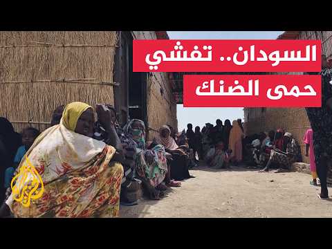 Health crisis worsens in Sudan: Dengue fever hits displaced persons camps in Tawila