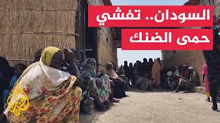 Health crisis worsens in Sudan: dengue fever hits displacement camps in Tawila