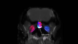 Tractogram of starling brain