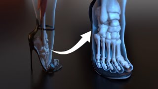 High Heels Change Your Bone Anatomy - 3D Animation