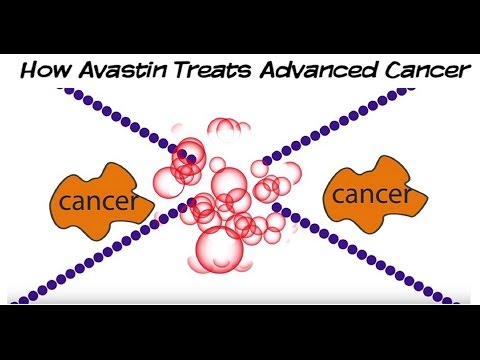 How Avastin (Bevacizumab) Targeted Therapy Treats Advanced Cancer